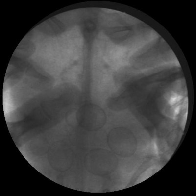 X-ray.jpg